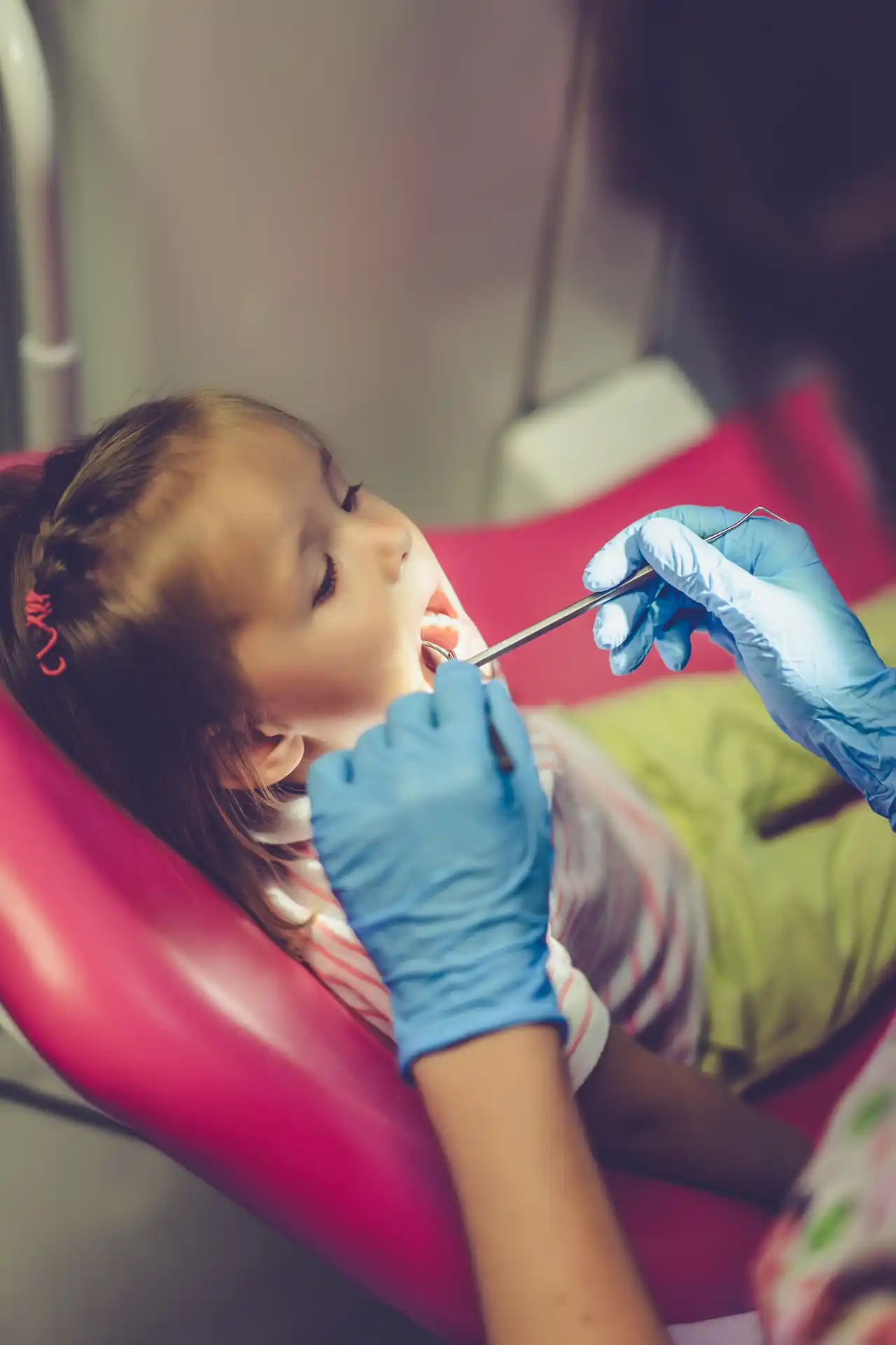 Fluoride Treatment