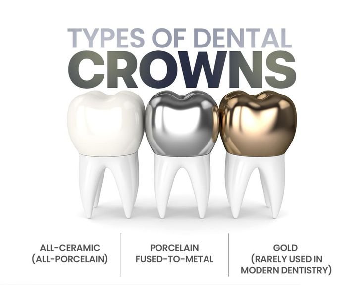 Importance of pediatric crowns in preserving baby teeth
